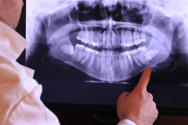 Best Emergency Dental Extractions in Burlington, OH